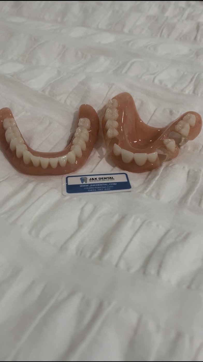 Upper and lower complete dentures