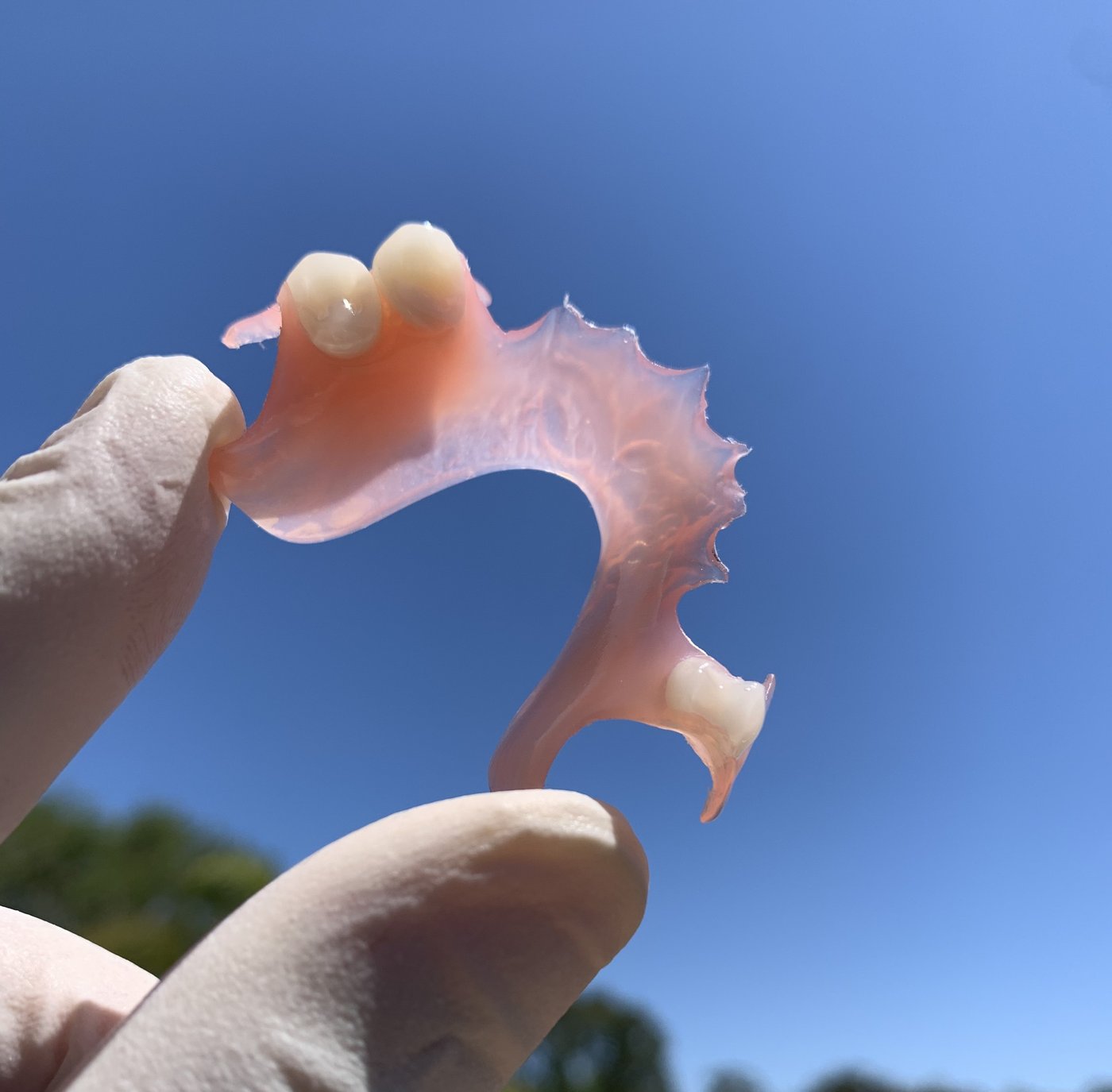 Flexible partial denture detail